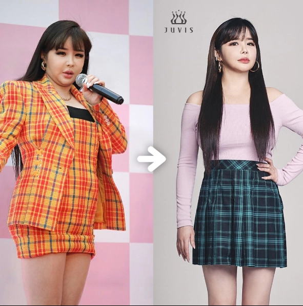 Idol vạn người mê park bom xuất hiện mũm mĩm gương mặt khác lạ khiến fans ruột nhận khó ra - 10
