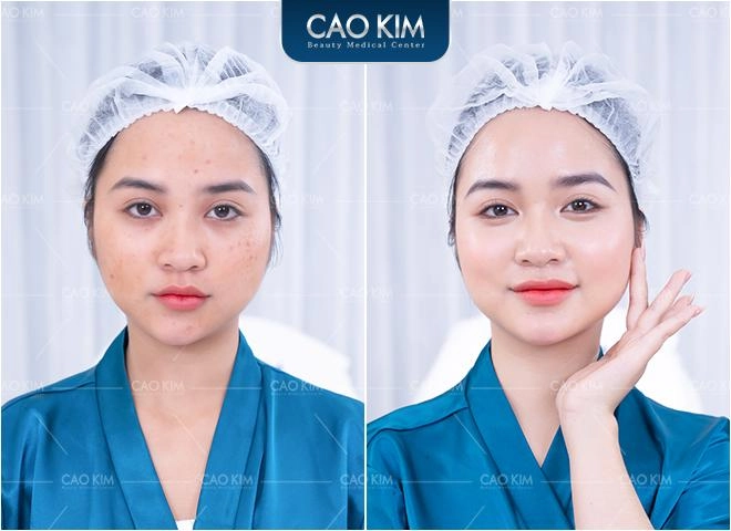 Viện thẩm mỹ cao kim - địa chỉ làm đẹp không xâm lấn chiếm trọn lòng tin của phái đẹp - 6