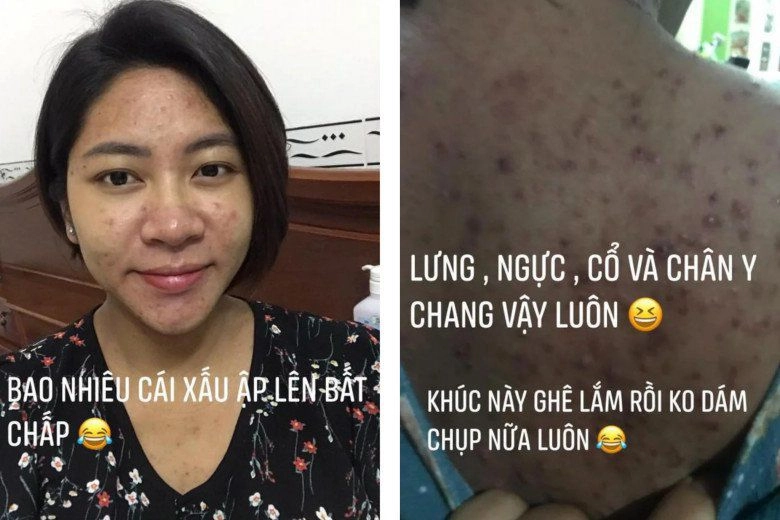 Được chị gái khen đẹp tự nhiên hơn thùy tiên hoa hậu đặng thu thảo bị đào lại quá khứ hút mỡ bụng - 3