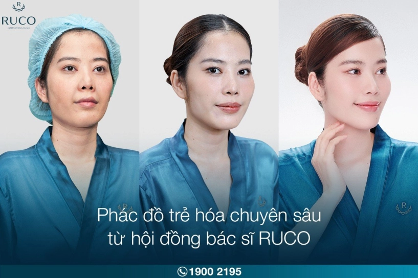 Nhan sắc ngày càng thăng hạng của nam em hậu trùng tu tại ruco - 4