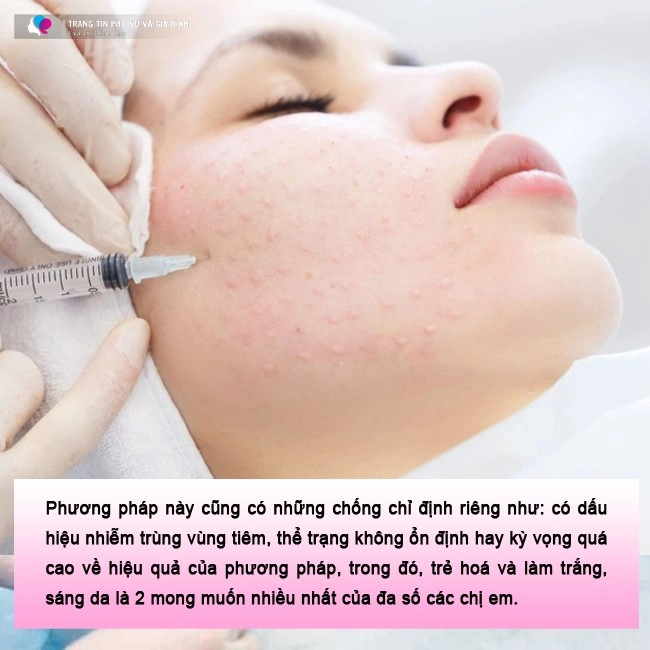 Làm đẹp kiểu mì ăn liền với phương pháp tiêm meso cẩn thận với các chuyên gia bắt chước nửa vời - 4