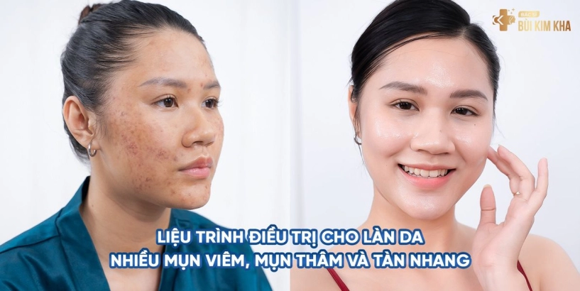 Bác sĩ thẩm mỹ kim kha giúp chị em duy trì vẻ xuân sắc của làn da - 3