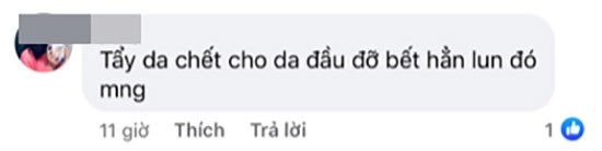 Cđm truyền tay nhau công thức trị tóc bết nặng đô như đổ dầu nhớt cũng chữa được - 4