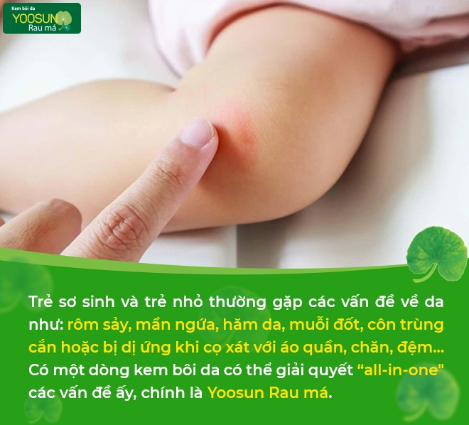 Có gì bên trong yoosun rau má - tuýp kem xử lý các vấn đề về da của trẻ - 1