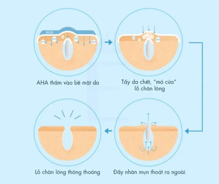 Bác sĩ da liễu tiết lộ bước quan trọng nhất khi chống lão hóa da chấn động vì chẳng mất đồng nào - 3