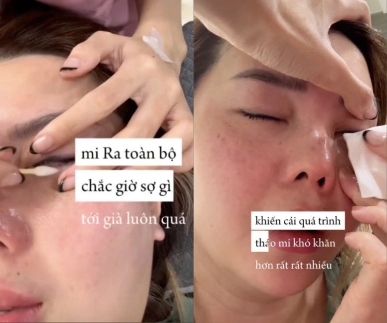 Beauty blogger bị bỏng khi đi nối mi giác mạc thành từng lỗ lời cảnh tỉnh cho chị em - 2