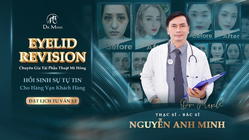 Dr minh - chuyên gia tái phẫu thuật mí hồi sinh đôi mắt hồi sinh tự tin - 1