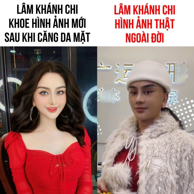 Lâm khánh chi hậu tháo băng mặt trông hệt búp bê sống fans ruột cũng nhận khó ra - 4