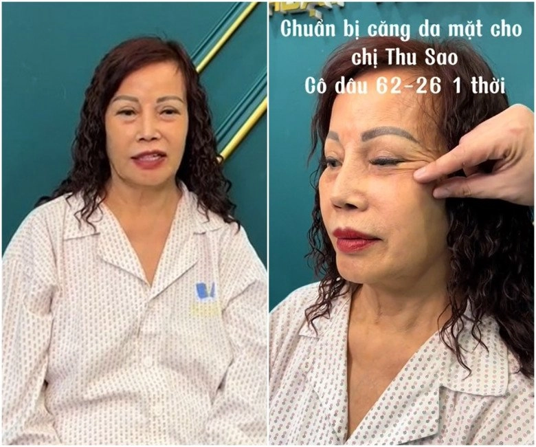 Cô dâu thu sao đi căng da mặt lần thứ n dù miệng méo xệch vẫn quyết giấu chồng trẻ hóa - 2