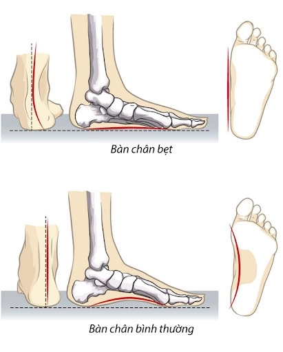 4 kiểu giày dép đẹp nhưng độc có cho tiền cũng không nên mua kẻo hỏng vóc dáng lẫn rước loạt hậu họa - 9