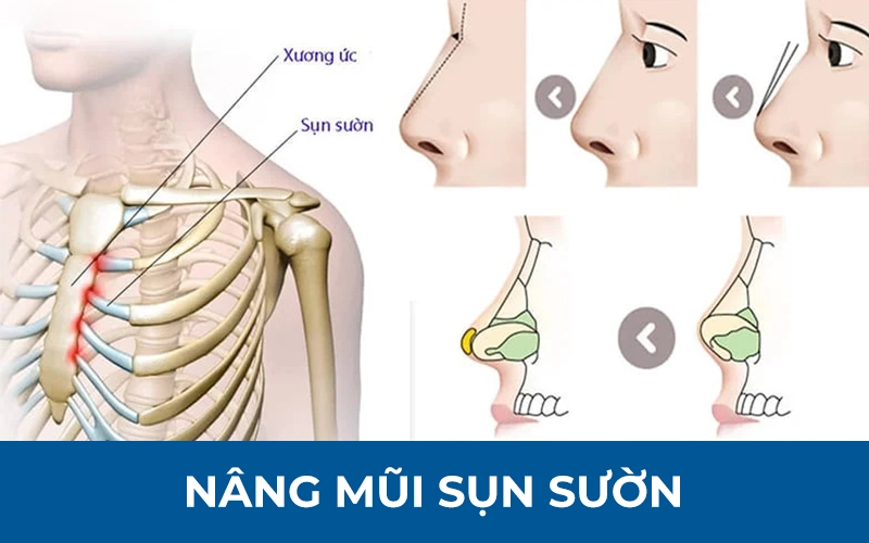 Nên làm gì với mũi hỏng lời khuyên từ bác sĩ cki trần đắc quang - 3