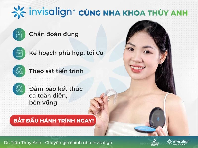 Niềng răng trong suốt invisalign tại nha khoa thùy anh - 4