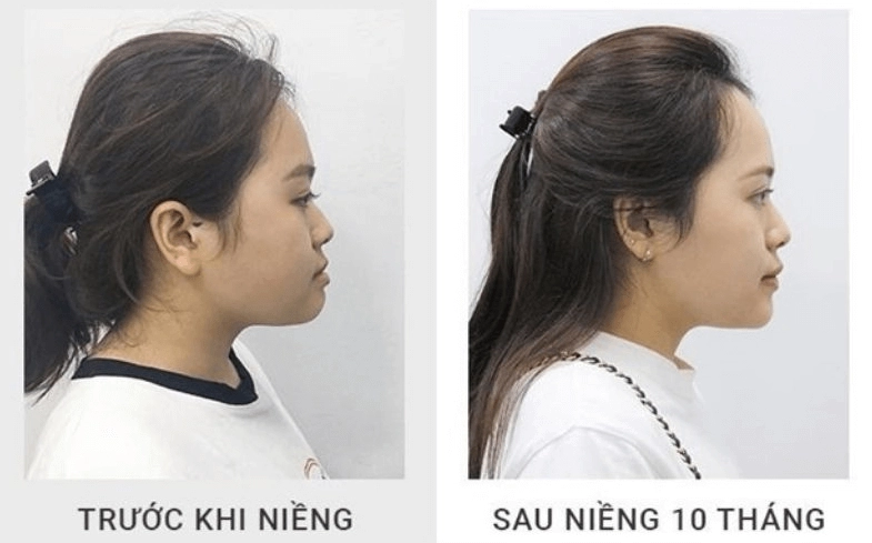 Ý nhi khoe lại ảnh dự lễ khai giảng bên bạn trai lộ một điểm nhan sắc đã sửa trước khi thi hoa hậu - 12