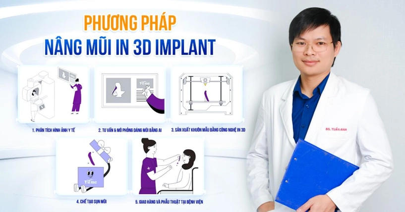 Bác sĩ nguyễn tuấn anh ứng dụng thành công công nghệ nâng mũi in 3d implant - 1