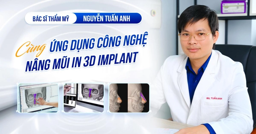 Bác sĩ nguyễn tuấn anh ứng dụng thành công công nghệ nâng mũi in 3d implant - 2