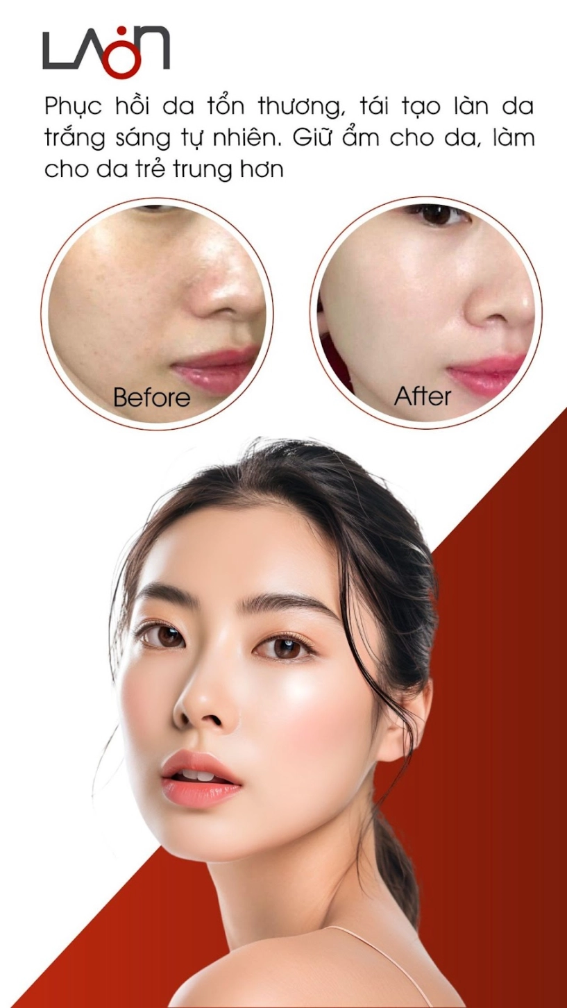 Tinh hoa thảo dược tự nhiên trong kem nám melasma laonmedi - 4