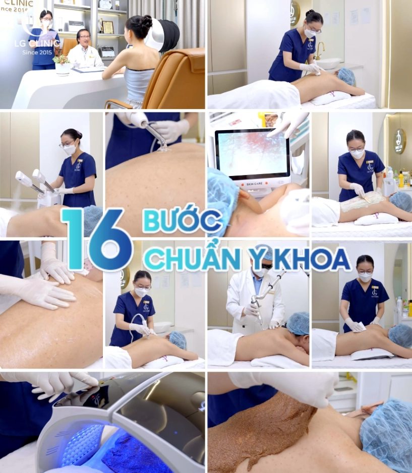 Acthyderm - co2 công nghệ trị mụn thế hệ mới không xâm lấn không để lại sẹo - 3