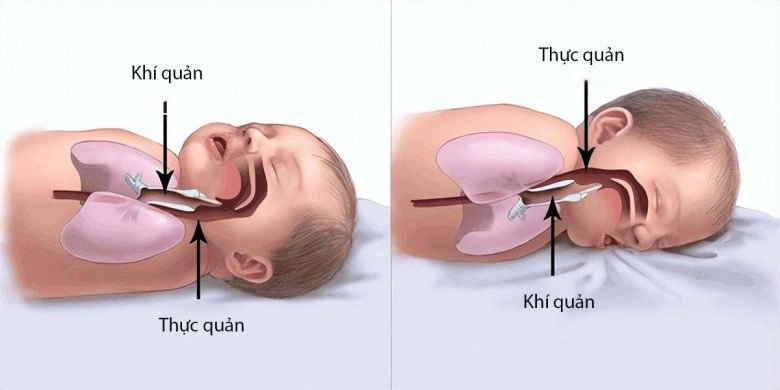 Bé gái 2 tuổi ra đi mãi mãi lúc đang nằm ngủ người mẹ gục ngã khi biết lỗi do mình - 3