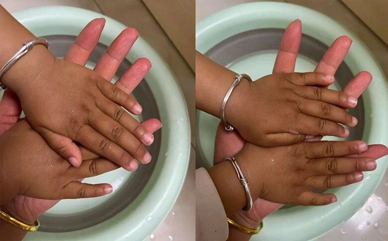 Bé sơ sinh chào đời da trắng hồng xinh như thiên thần 2 năm sau mẹ nghi ngờ không phải con ruột - 3