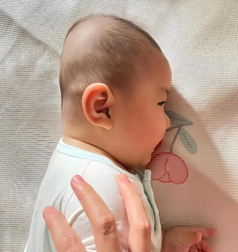Bé trai 2 tháng tuổi nhập viện vì bà nội bắt nằm ngửa ngủ bác sĩ tức giận quá muộn rồi - 2
