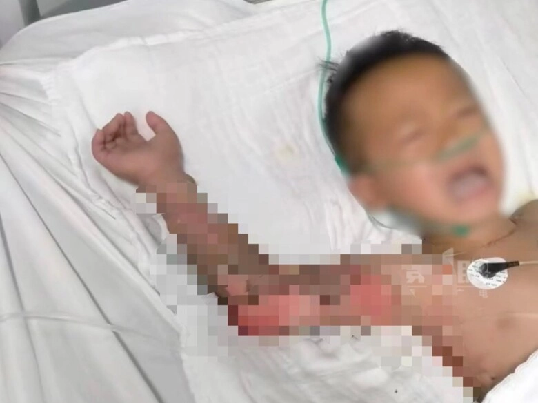 Bé trai đang chơi trong nhà thì hét lớn vì tay bốc lửa phản ứng của bà nội làm ai cũng phẫn nộ - 5