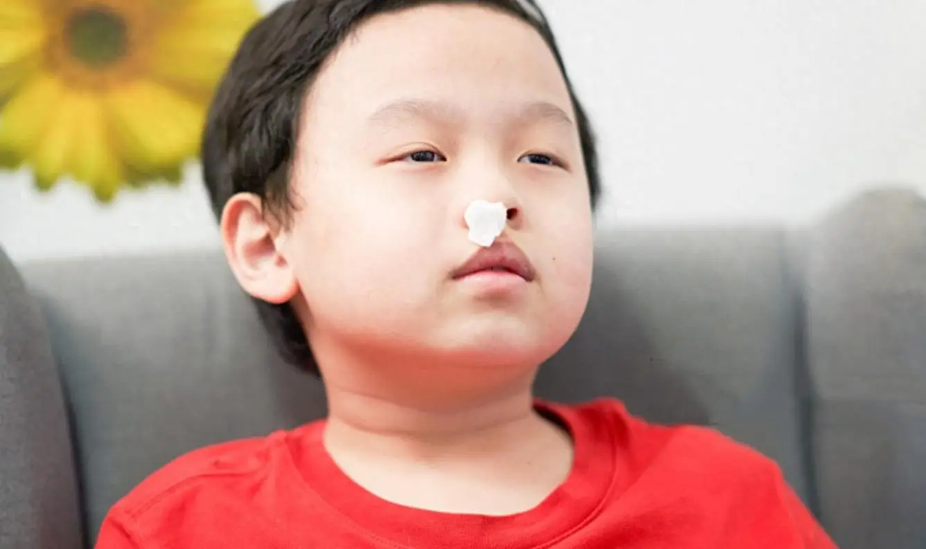 Cháu trai bị chảy máu mũi bà ngoại bảo đứa trẻ ngửa đầu ra sau đến bệnh viện bác sĩ lắc đầu nói không cứu được - 1