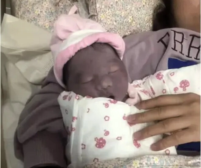 Con sơ sinh chào đời làn da tím tái kỳ lạ bố mẹ đau lòng nghĩ con bệnh 2 tháng sau điều bất ngờ xảy ra - 1
