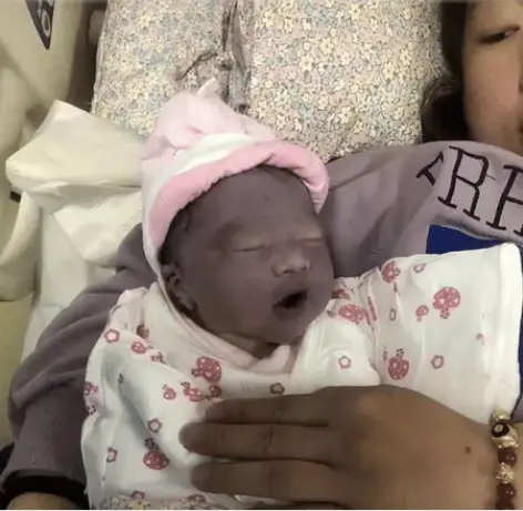 Con sơ sinh chào đời làn da tím tái kỳ lạ bố mẹ đau lòng nghĩ con bệnh 2 tháng sau điều bất ngờ xảy ra - 2