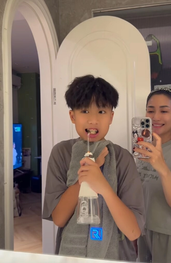 Con trai cả ốc thanh vân gương mặt sáng ngũ quan hài hòa mẹ cho đi can thiệp thẩm mỹ sớm - 2