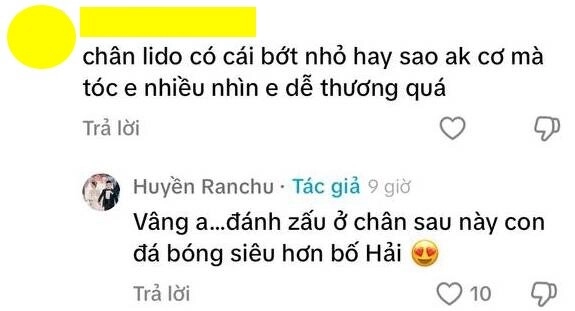 Vợ quang hải đáp khéo khi con trai mới sinh bị soi vết bớt ở chân trái - 2