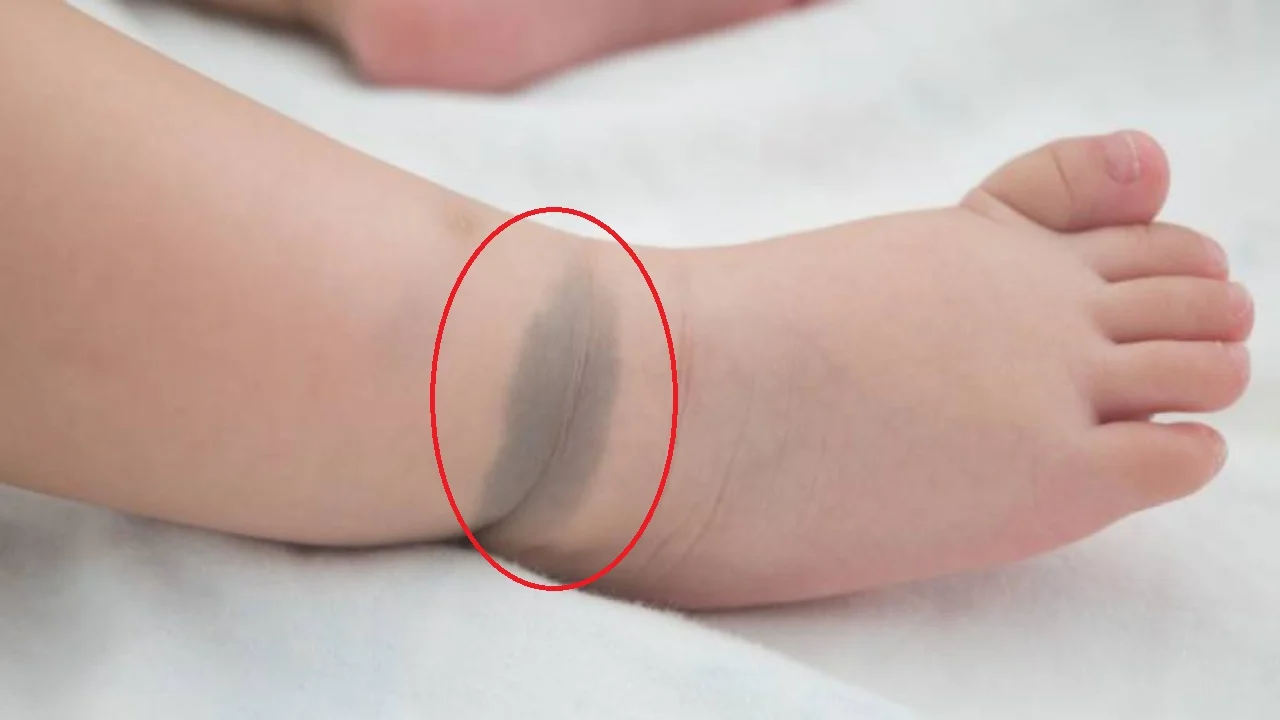 Con vừa chào đời có vết bớt xanh ở mông chồng tức giận muốn đem cho mẹ chồng lý giải sự thật - 4