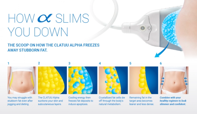 Giải mã cỗ máy đông hủy mỡ triệu đô clatuu alpha - có thật sự hiệu quả - 2