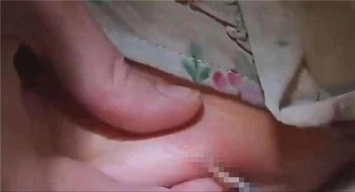 Gửi con về bà nội 1 tháng mẹ sững người khi đón lên nặn ở lưng con giòi sống 2cm - 2