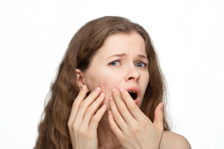 Hyaluronic znpca và b5 của ekseption bộ đôi cứu tinh mùa hè cho làn da dầu mụn - 1