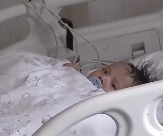Bé 5 tháng tuổi không đi tiểu trong 20 giờ bị sưng khắp người bác sĩ phát hiện nguyên nhân đến từ bữa ăn hàng ngày - 1
