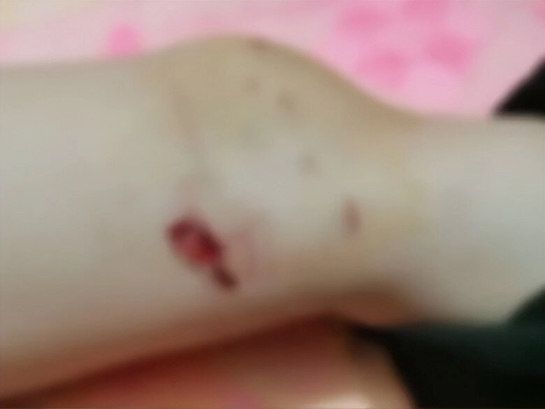 Bé gái 5 tuổi bị chó nhà hàng xóm bất ngờ tấn công húc ngã xuống đất khi đi bộ trên đường phải nhập viện gấp - 3