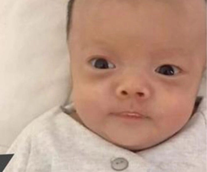 Bé sơ sinh chào đời có diện mạo như ông già suýt bị bỏ rơi giờ đứa trẻ lột xác khiến mẹ ngỡ ngàng - 2