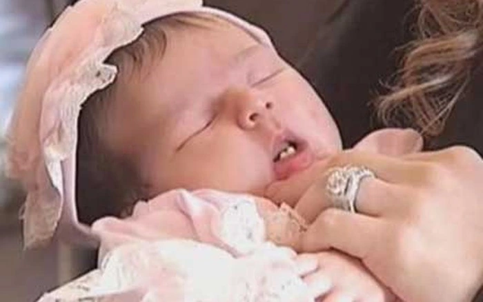 Bé sơ sinh vừa chào đời đã có răng cả khoa hội chẩn phải nhanh lấy nó ra - 3