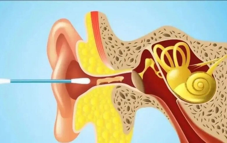 Bé trai 10 tuổi bị mất thính lực sau khi đi bơi về đến bệnh viện bác sĩ đưa ra cảnh báo khẩn cấp - 2