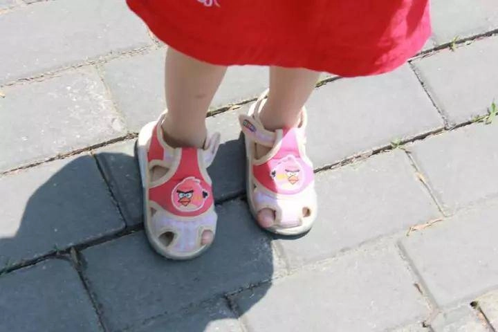 Bố đưa con 2 tuổi đi bơi lúc về phát hiện ngón chân con phù lên đỏ tấy đến bệnh viện bác sĩ báo tin sốc - 3