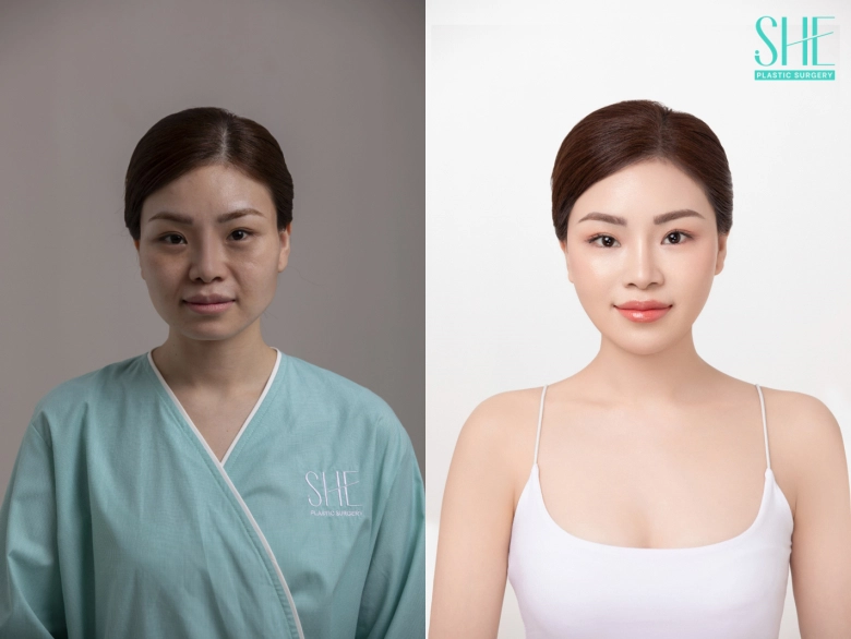 chạm đến vẻ đẹp tự tin phẫu thuật thẩm mỹ she nơi phụ nữ tìm lại chính mình - 4