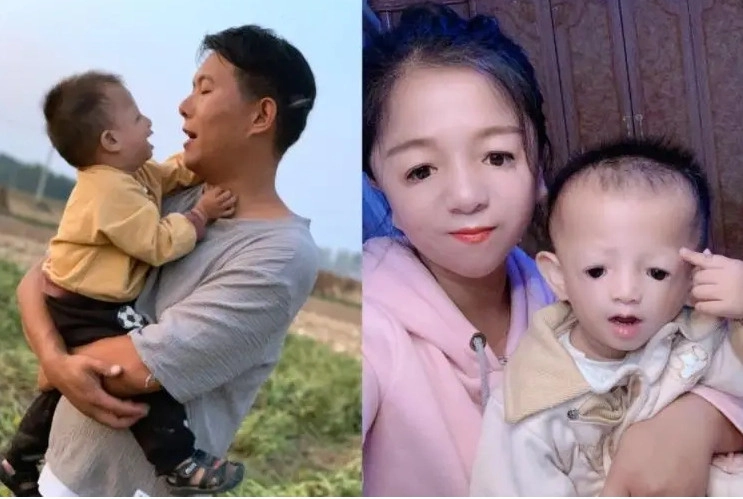 Cô gái mặt chim từng bị xa lánh giờ sống ra sao sau khi sinh 2 con - 3