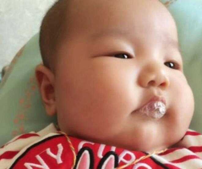 Con 2 tháng tuổi thường xuyên thổi bong bóng mẹ tưởng hành động dễ thương nhưng bác sĩ bắt nhập viện ngay lập tức - 1