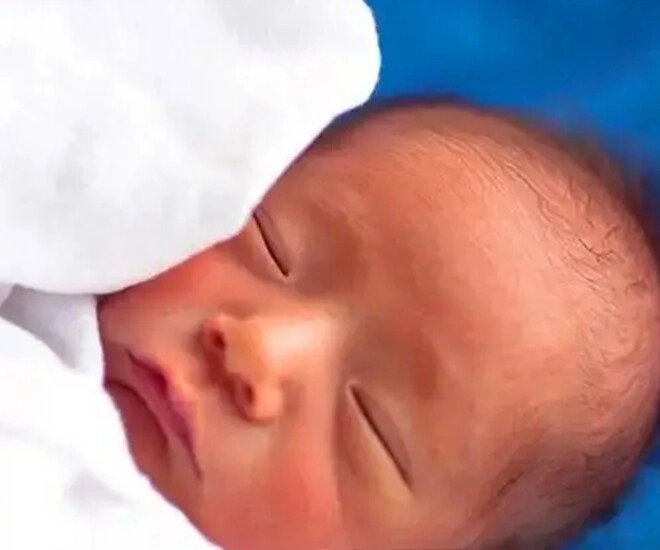 Con chào đời 1 tuần vẫn chưa mở mắt bố mẹ vội vã đưa đến bệnh viện bác sĩ bật cười - 1