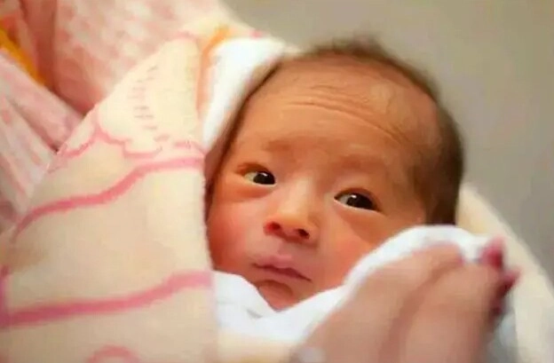 Con chào đời 1 tuần vẫn chưa mở mắt bố mẹ vội vã đưa đến bệnh viện bác sĩ bật cười - 4