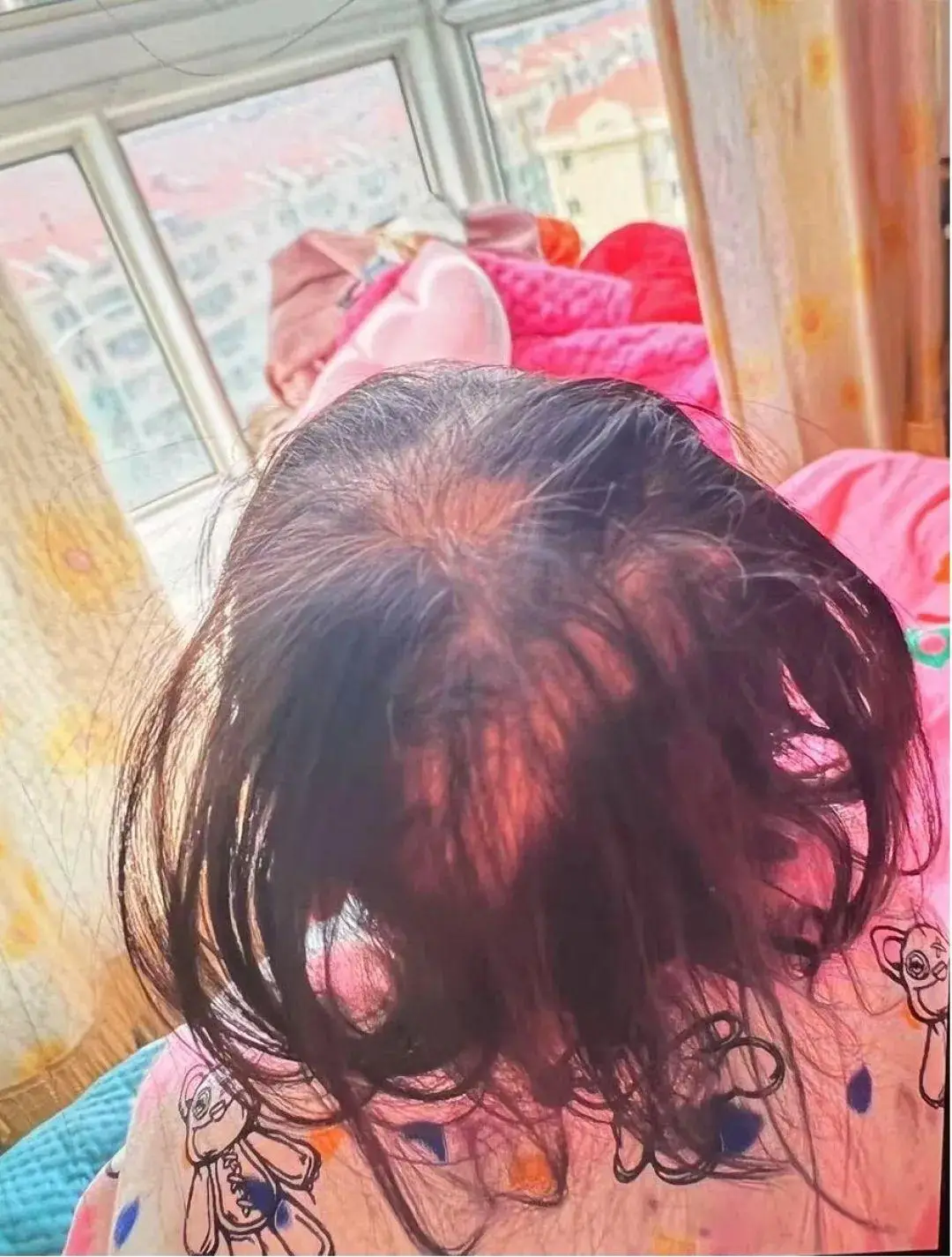 Con gái 3 tuổi rụng gần hết tóc mẹ đưa đến bệnh viện bác sĩ nói hãy báo cảnh sát - 2