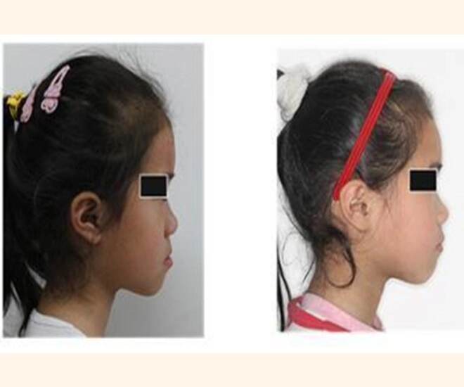Con gái lúc nhỏ đẹp nhưng càng lớn càng móm đến bệnh viện bác sĩ nói nguyên nhân khiến gia đình suy sụp - 1