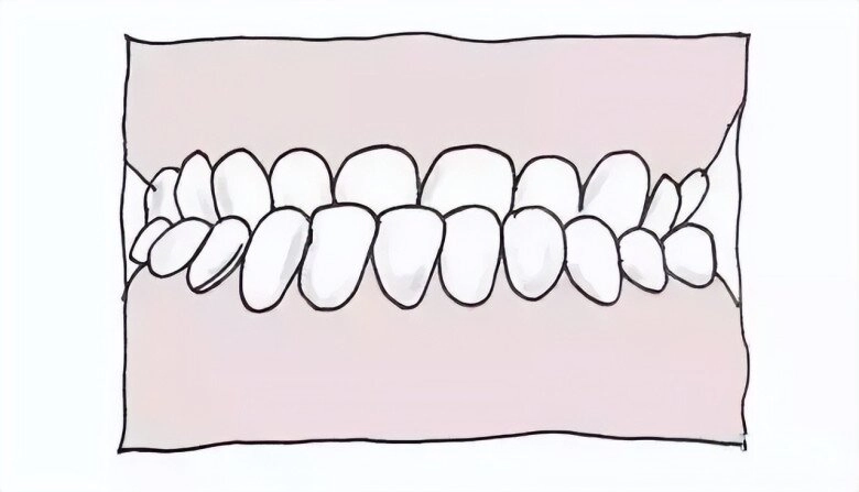 Con gái lúc nhỏ đẹp nhưng càng lớn càng móm đến bệnh viện bác sĩ nói nguyên nhân khiến gia đình suy sụp - 3