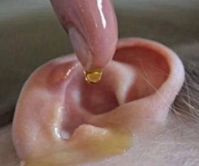 Con gái mẫu giáo bị sinh vật lạ chui vào tai chỉ với một hành động người mẹ được bác sĩ khen rất thông minh - 1