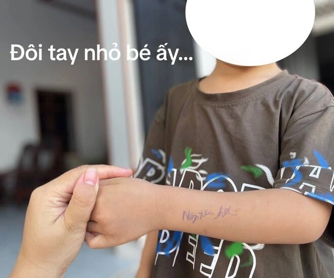 Dòng chữ kém duyên trên cánh tay học sinh mầm non do cô giáo viết khiến gia đình tức giận mẹ việt tranh cãi - 1